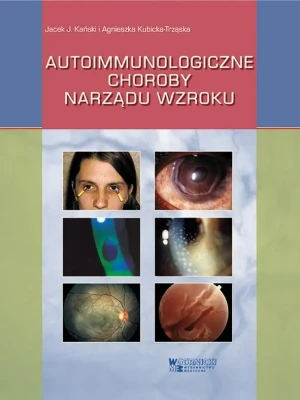 Autoimmunologiczne choroby narządu wzroku - Agnieszka Kubicka-Trząska - książka