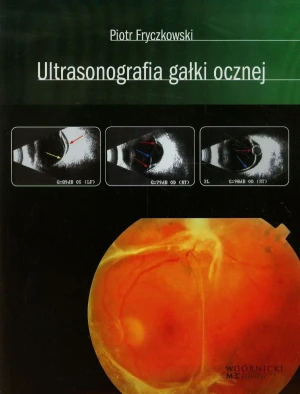 Ultrasonografia gałki ocznej - Fryczkowski Piotr - książka