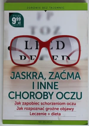 JASKRA ZAĆMA I INNE CHOROBY OCZU ZDROWIE BEZ TAJEMNIC 05/2015 - Praca zbiorowa - książka