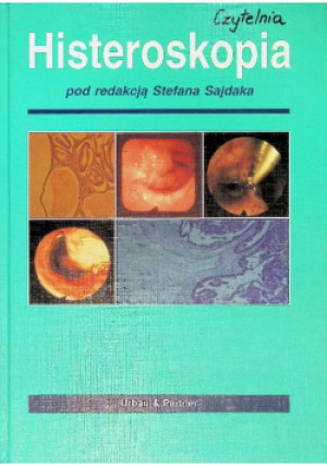 Histeroskopia - Stefan Sajdak - książka  wyd. 2000