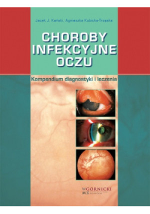 Choroby infekcyjne oczu - Jacek J. Kański, Agnieszka Kubicka-Trząska - książka  wyd. 2021