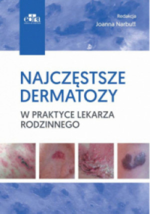 Najczęstsze dermatozy w praktyce lekarza rodzinnego - Joanna Narbutt - książka  wyd. 2019