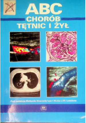 ABC chorób tętnic i żył - książka  wyd. 2002