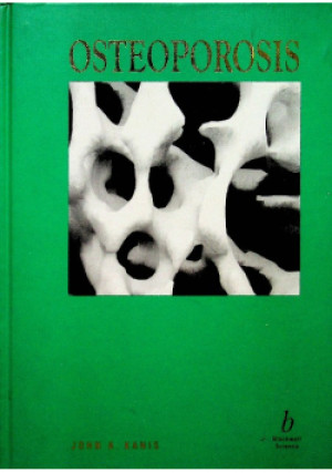 Osteoporosis - John Kanis - książka  wyd. 1994