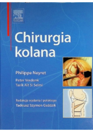 Chirurgia kolana - Tarik Ait Si Selmi, Peter Verdonk - książka  wyd. 2010