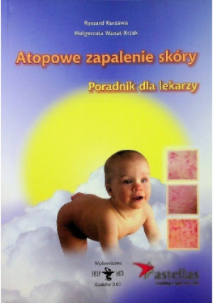 Atopowe zapalenie skóry - Ryszard Kurzawa - książka  wyd. 2007