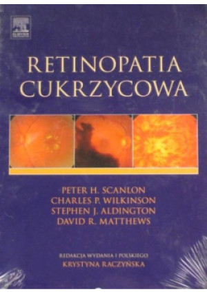 Retinopatia cukrzycowa - Peter H. Scanlon, David R. Matthews, Charles P. Wilkinson, Stephen J. Aldington - książka  wyd. 2012