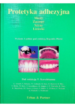 Protetyka adhezyjna - Bogumił Płonka - książka  wyd. 1995