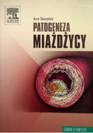 Patogeneza miażdżycy - Anna Skoczyńska - książka  wyd. 2006