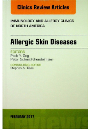 Allergic Skin Diseases - Praca Zbiorowa - książka  wyd. 2017