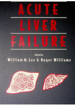 Acute Liver failure - William M. Lee - książka  wyd. 1997