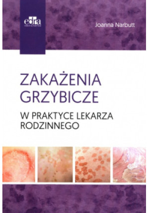 Zakażenia grzybicze w praktyce lekarza rodzinnego - Joanna Narbutt - książka  wyd. 2021
