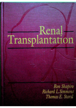 Renal Transplantation - Ron Shapiro, Richard L. Simmons, Thomas E. Starzl - książka  wyd. 1997