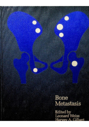 Bone Metastasis - Leonard Weiss - książka  wyd. 1981