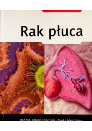 Rak płuca - Jerzy Kołodziej - książka  wyd. 2010