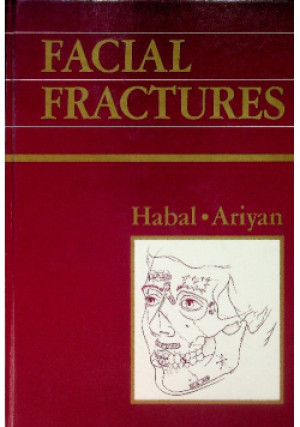 Facial Fractures - Stephan Ariyan - książka  wyd. 1989