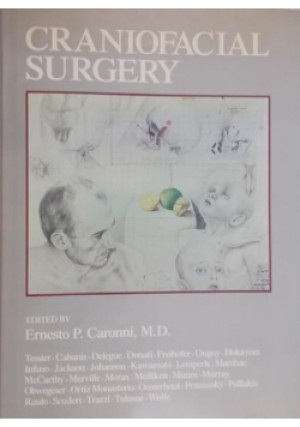 Craniofacial Surgery - Ernesto P Caronni - książka  wyd. 1985