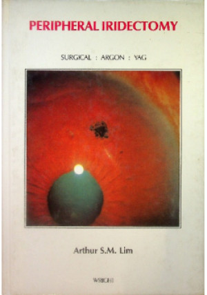 Peripheral Iridectomy - Arthur S.M. Lim - książka  wyd. 1987