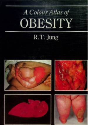 A Colour Atlas of Obesity. - R. T. Jung - książka  wyd. 1990