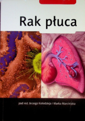 Rak płuca - Jerzy Kołodziej - książka  wyd. 2010
