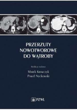 Przerzuty nowotworowe do wątroby - Marek Krawczyk - książka  wyd. 2020