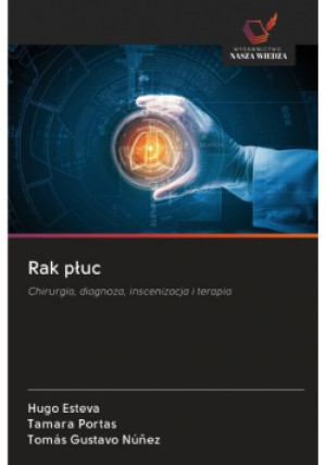 Rak płuc - Hugo ESTEVA - książka  wyd. 2020