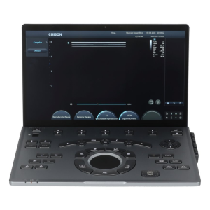 Ecógrafo Portátil Chison SonoAir 70 (Compra, alquila o financia)