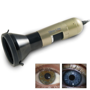 Iriscopio Dino-Lite: Permite crear fácilmente imágenes nítidas de los ojos y los iris