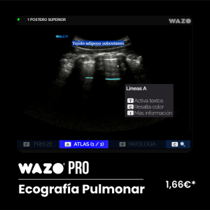 Software de Simulación Clínica en Ecografía Pulmonar: Suscripción Anual WAZO® PRO - Pulmonar y Pleural