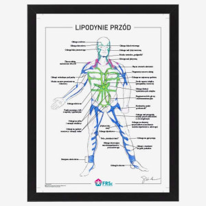 Plakat anatomiczny - Lipodynie 30x40 cm - przód - w ramce