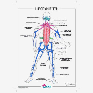 Plakat anatomiczny - Lipodynie 30x40 cm - tył - bez ramki