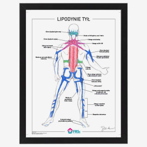 Plakat anatomiczny - Lipodynie 30x40 cm - tył - w ramce