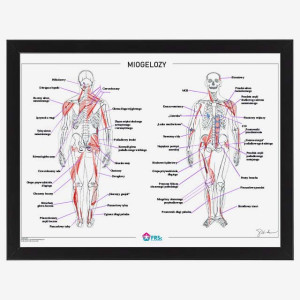 Plakat anatomiczny - Miogelozy 30x40 cm - w ramce