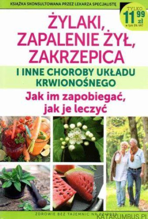 ŻYLAKI ZAPALENIE ŻYŁ ZAKRZEPICA I INNE CHOROBY UKŁADU KRWIONOŚNEGO