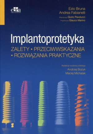 IMPLANTOPROTETYKA ZALETY PRZECIWWSKAZANIA E BRUNA
