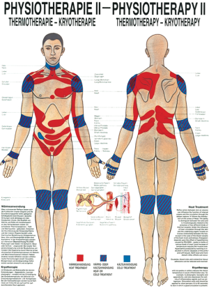 «Thermotherapie», laminiert Miniposter 24 x 34 cm laminiert