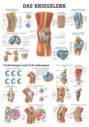«Das Kniegelenk», laminiert Tafel 70 x 100 cm laminiert