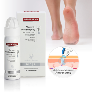 Pedibaehr Warzenvereiserspray für Hand- und Fußwarzen, 75 ml